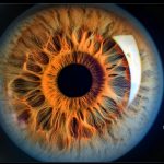 estereofoto de papila